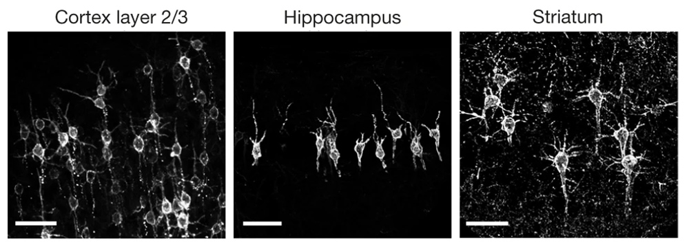 microscope image of neurons from mouse cortex, hippocampus and striatum