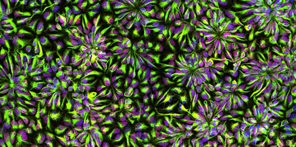 Cells labeled in green & blue cluster in interesting 'rosette' patterns