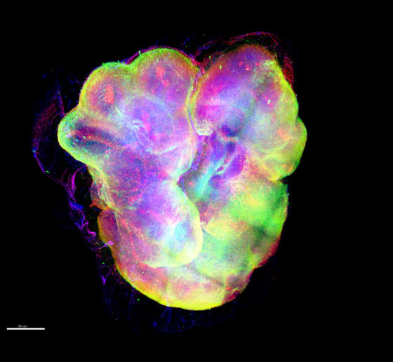 An organoid appears as a vaguely heart-shaped blob with many colors