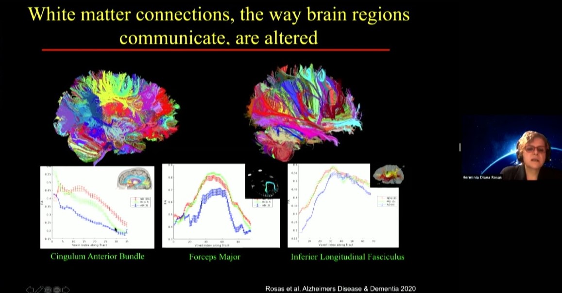 Diana Rosas shows a slide comparing two brain scans made up of color coded lines