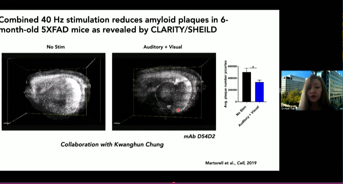 Li-Huei Tsai presents two mouse brain scans side by side. One has more white spots than the other.