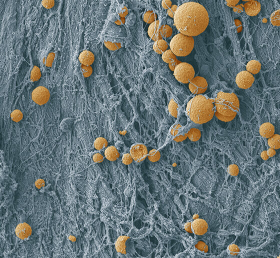 An electron microscopy image of cells and extracelluar matrix.