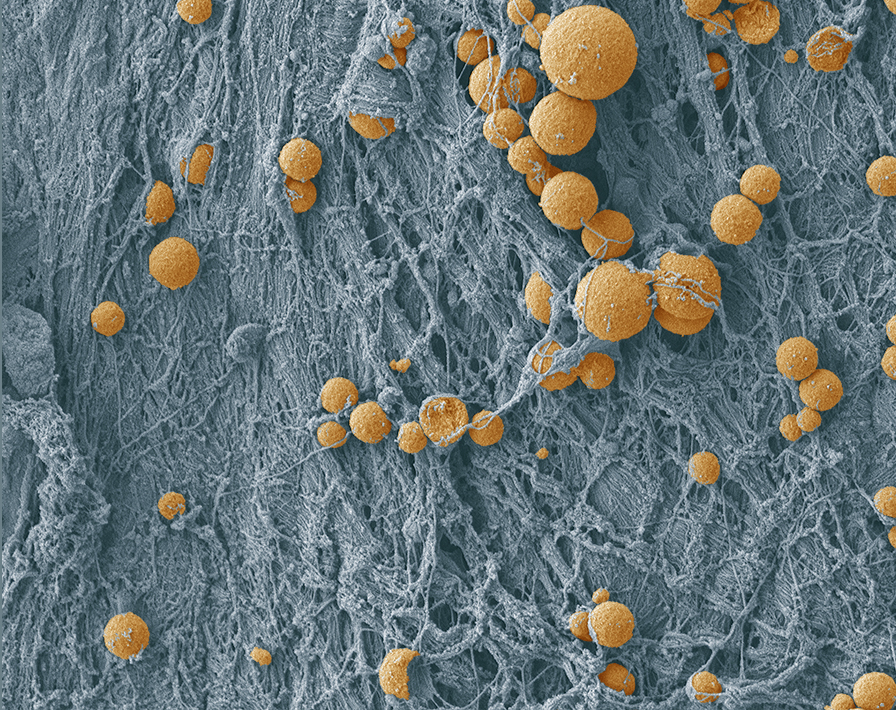 An electron microscopy image of cells and extracelluar matrix.